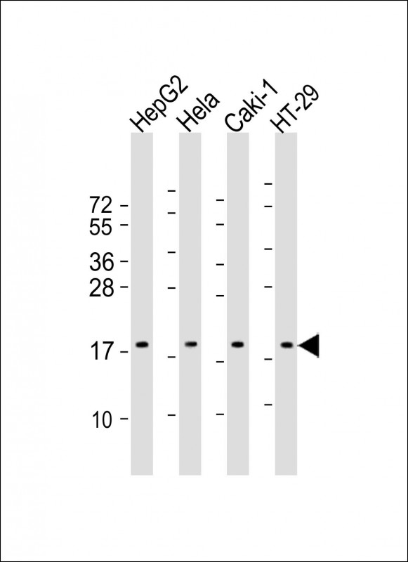 WB - ARF4 Antibody (Center) AP22186c